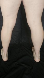 Rear view of Joshua Marron’s lower legs showing calf muscles for Project Legacy vegan body transformation progress photos.