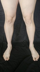Front view of Joshua Marron’s lower legs and feet, showcasing muscle definition for Project Legacy vegan fitness progress photos.