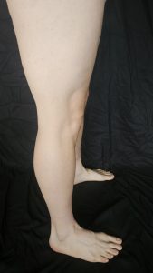 Right profile view of Joshua Marron’s lower leg and calf for Project Legacy vegan fitness progress photo.